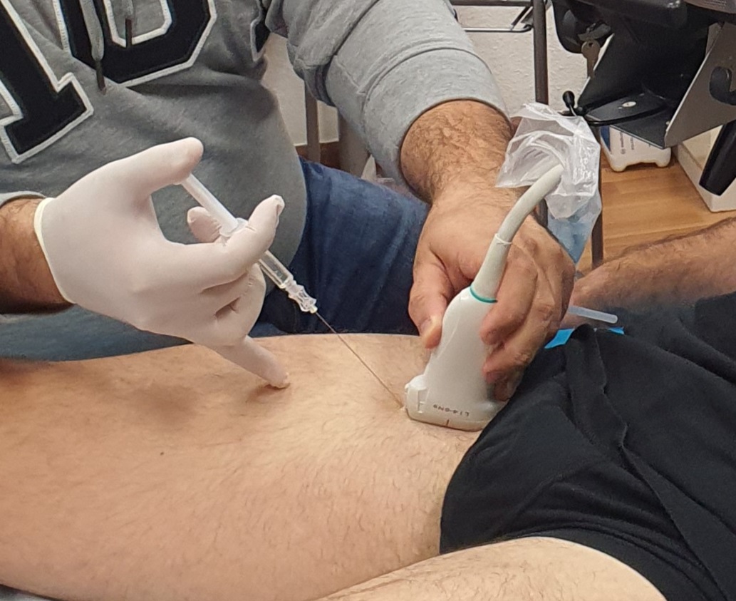 Adductor_injection_rpZoom