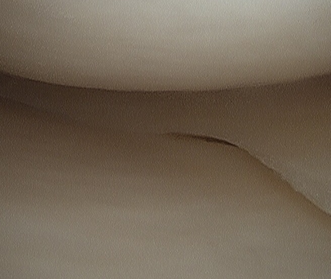 Cartilage and meniscus