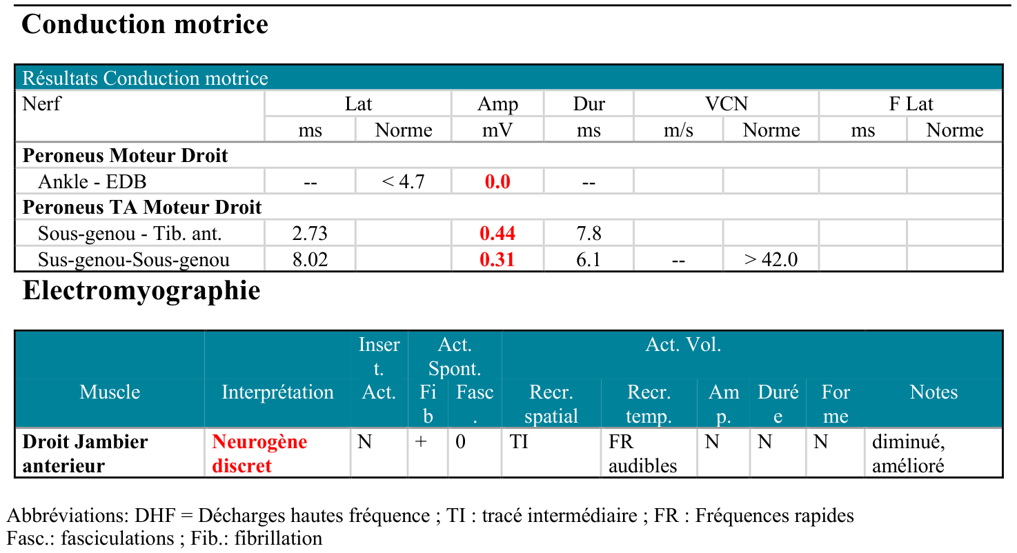 Motor neurography and needle-EMG results: absent EDB response, low-amplitude tibialis anterior responses and residual neurogenic changes.